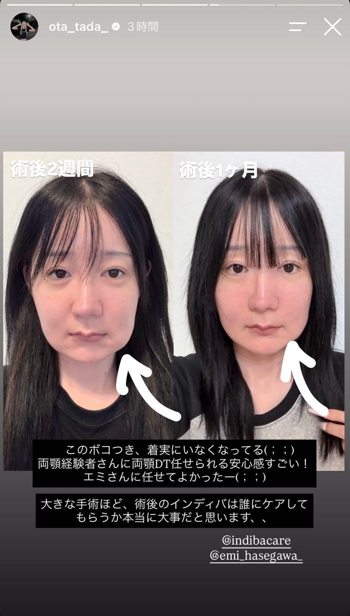多田さんInstagramストーリーズより