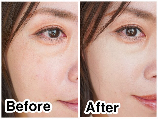 目の下beforeafter