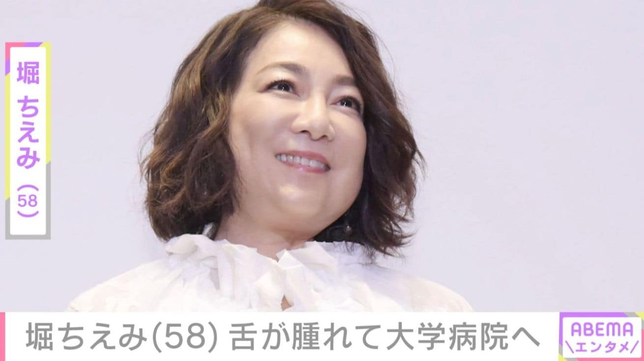 2019年に舌がん公表・堀ちえみ（58）、舌が腫れて大学病院へ「お大事に！」など様々な声