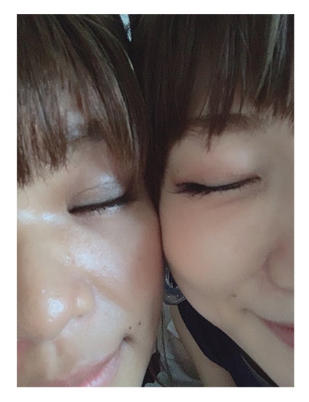 クロ、桃の整形後の目元／クロオフィシャルブログ（Ameba）より