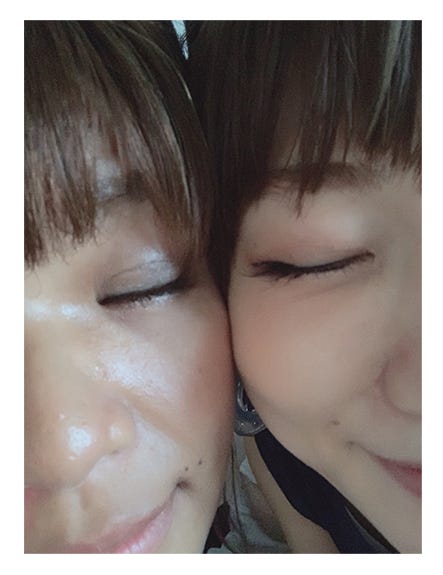 クロ、桃の整形後の目元/クロオフィシャルブログ(Ameba)より