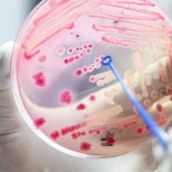 死者の5人に1人は「敗血症」 死因でがんを上回る