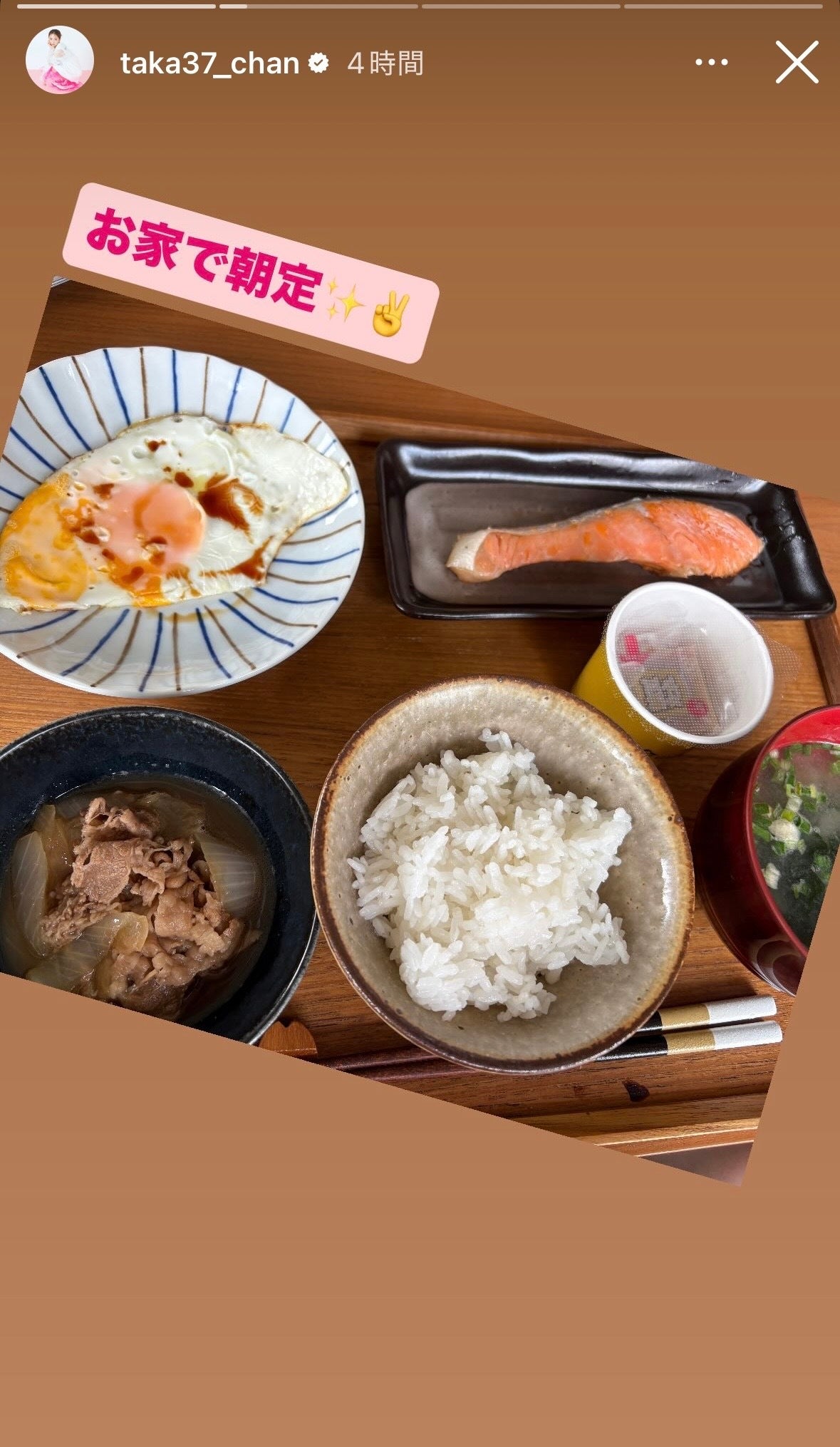 高橋みなみInstagramストーリーズより