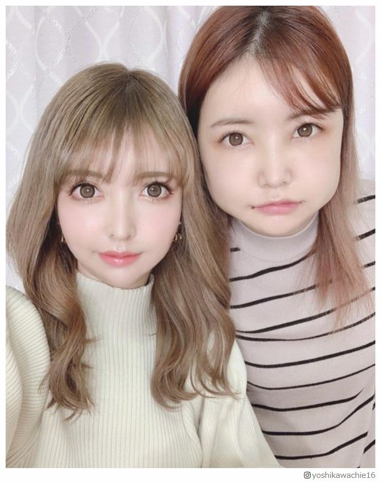 双子モデル・吉川ちえ、整形手術を報告 “輪郭の3点骨切り”オペ直後からの経過公開