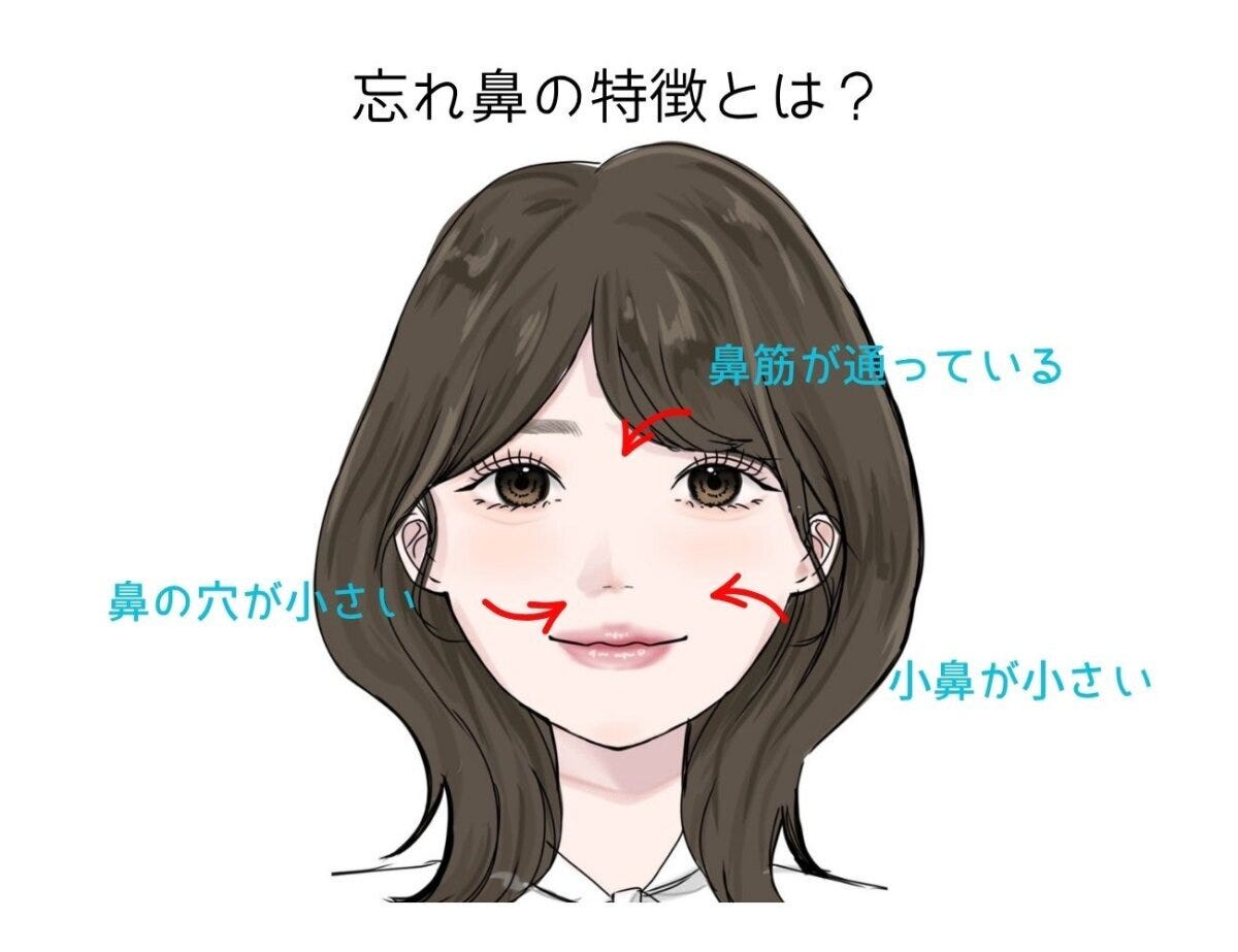 忘れ鼻の特徴