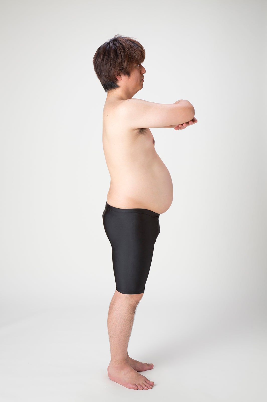 YUKINARI（ビフォー）（提供写真）