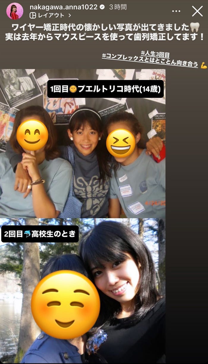 中川安奈アナ公式Instagramストーリーズより