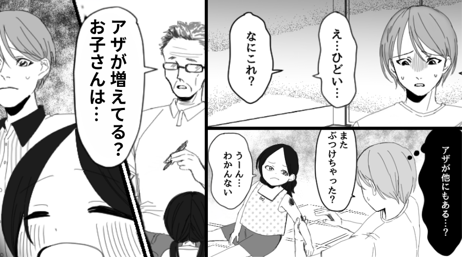 日に日に“アザが増える”娘？医者「お子さんは…」⇒告げられた【診断結果】に妻の血の気が引いたワケ