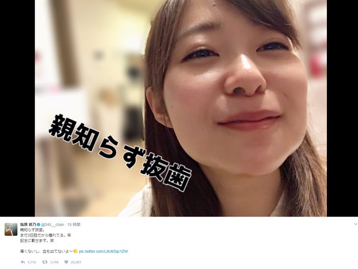 親知らず4本抜歯の指原莉乃 顔写真を公開 腫れすぎて笑っちゃう モデルプレス 親知らず4本抜歯の指原莉乃 顔写真を公開 腫れすぎて笑っちゃう モデルプレス