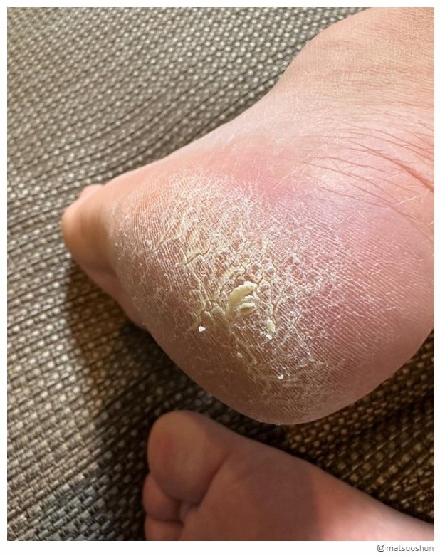 松尾駿Instagramより