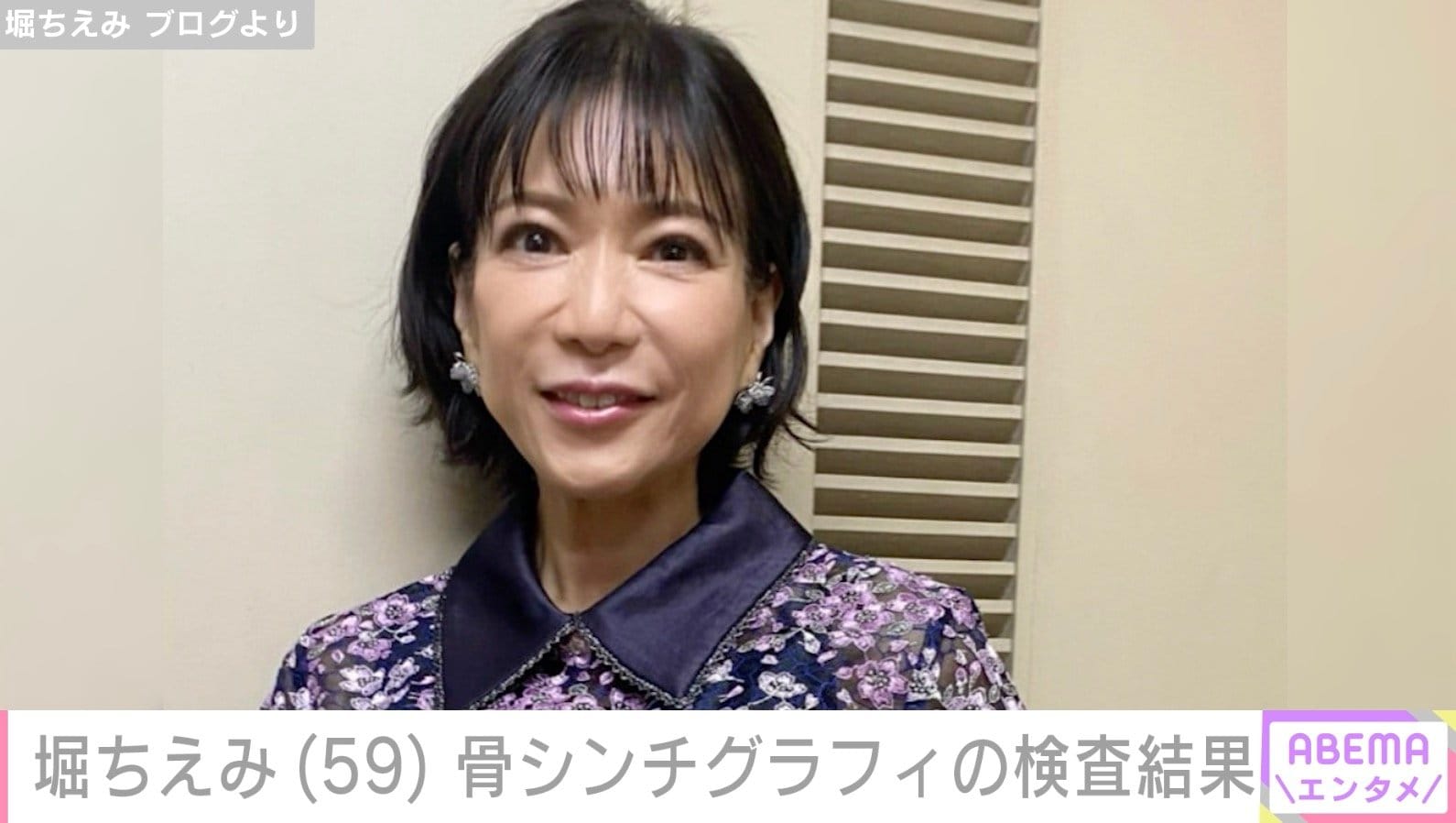 2019年に舌がん公表・堀ちえみ（59）、骨シンチグラフィの検査結果を報告「リウマチのお薬が増えました」