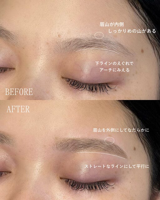 左右差の解消方法1