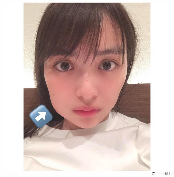 内田理央、親知らず抜歯で腫れ上がった顔写真を公開