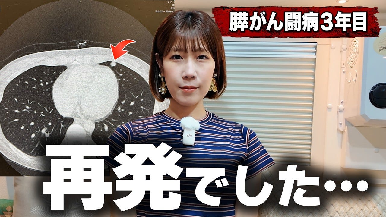 膵臓がん公表のYouTuberが生検の結果、再発していたことを報告