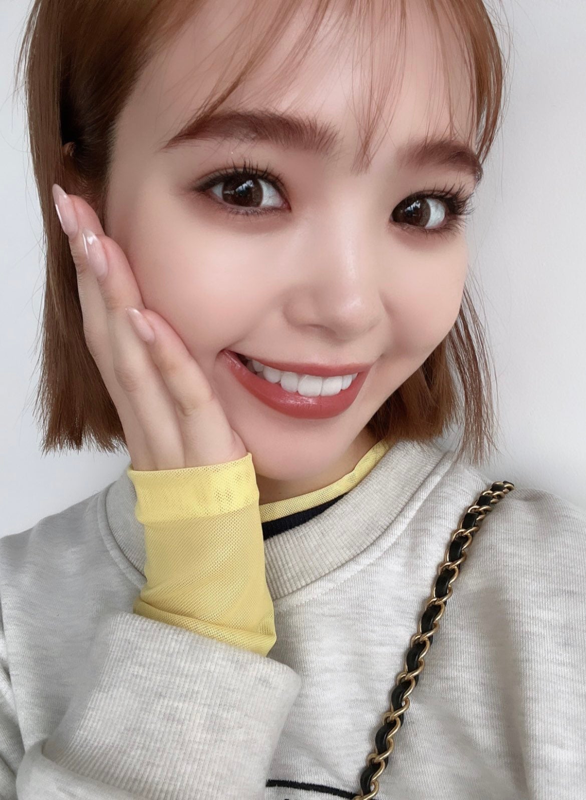 藤田ニコル、上下6本の歯がセラミックに “歯列矯正”ではない理由明かす