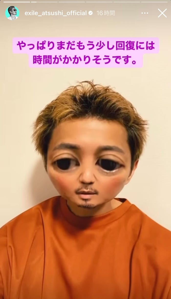 ATSUSHI Instagramストーリーズより