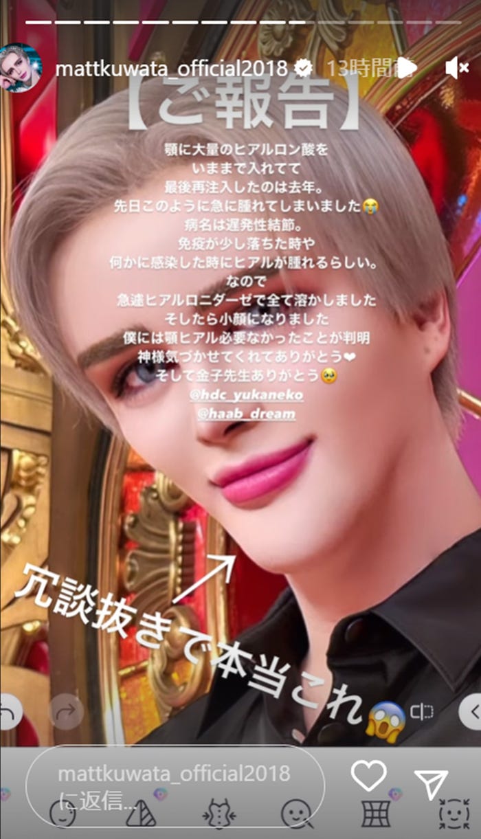 Matt Instagramストーリーズより