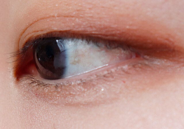 SUQQU　アイラッシュ　カーラー　Before