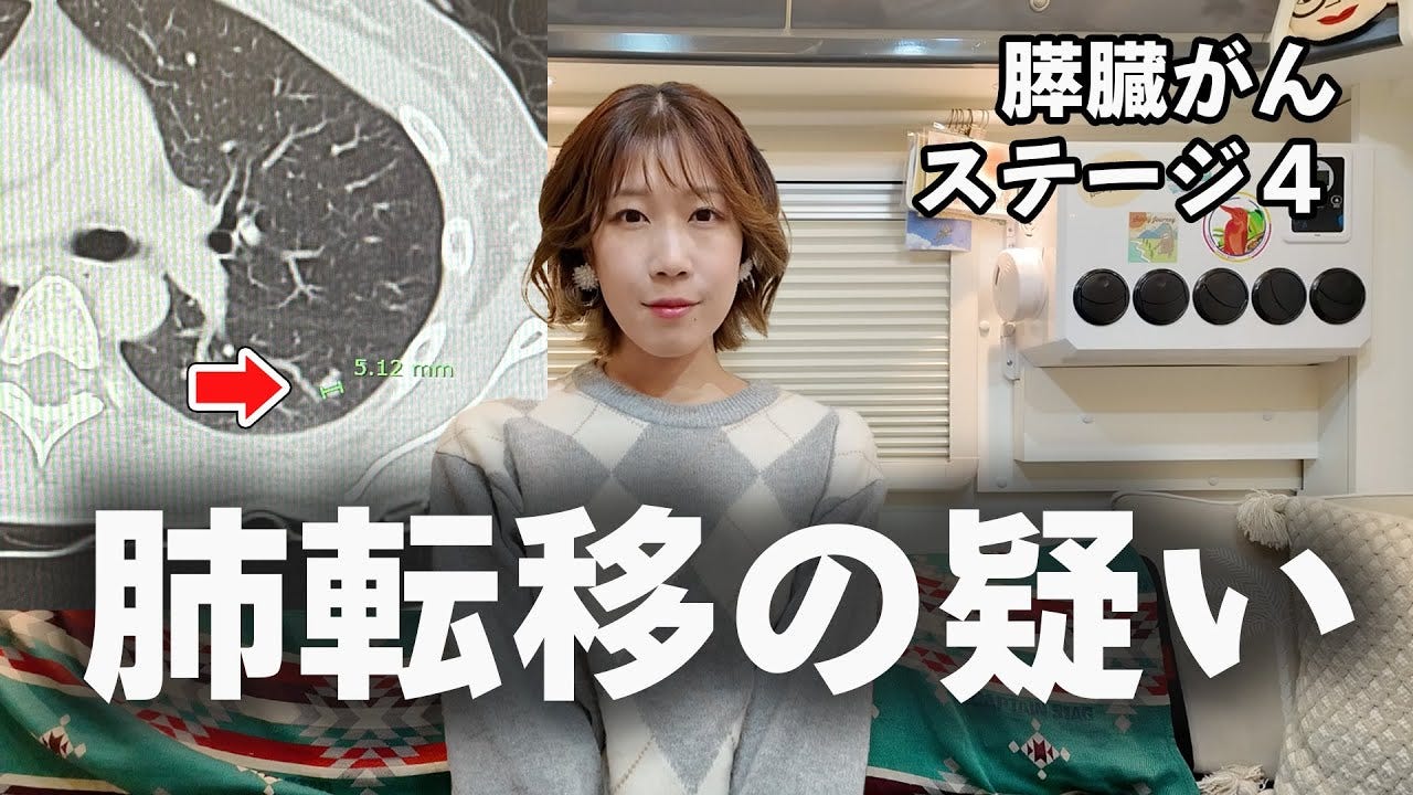 すい臓がん公表のサニージャーニー、肺転移の疑いがあることを報告