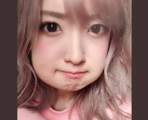 須藤凜々花、親知らず2本抜歯 頬が腫れ上がった自撮りに「加工かと思った」の声