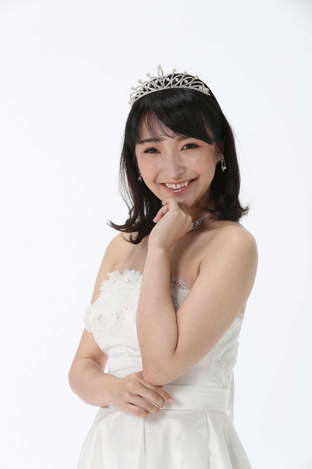 整形シンデレラオーディション／整形後 （提供写真）