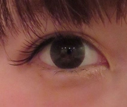 二重整形手術から3週間後の桃の目/桃オフィシャルブログ(Ameba)より