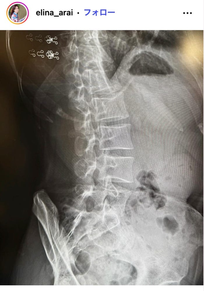 新井恵理那Instagramより