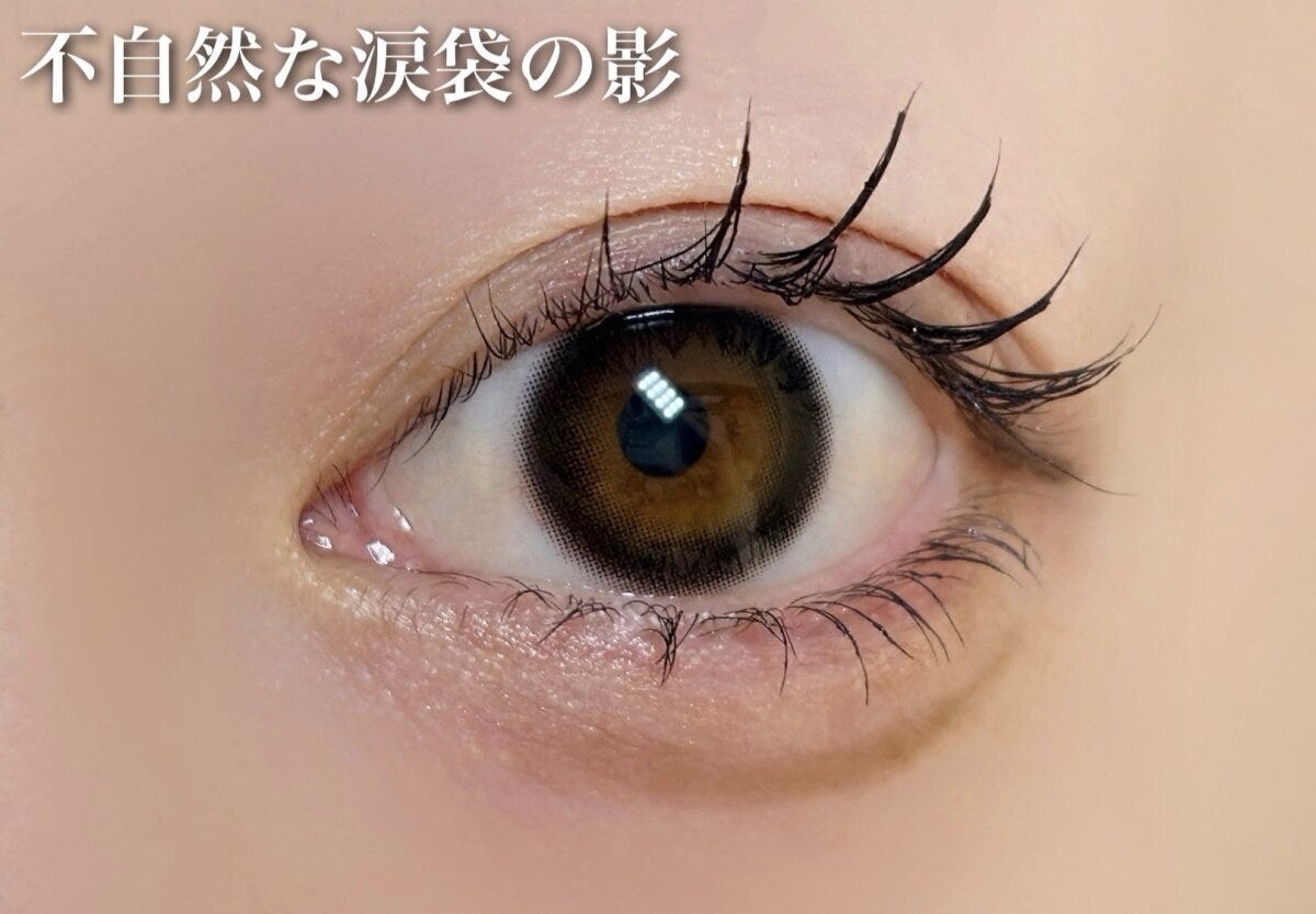 不自然な涙袋の影 不自然な涙袋の影