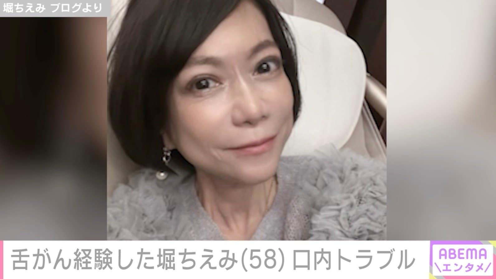 2019年に舌がん公表・堀ちえみ（58）、口内トラブルで治療へ「病のすべては口から」