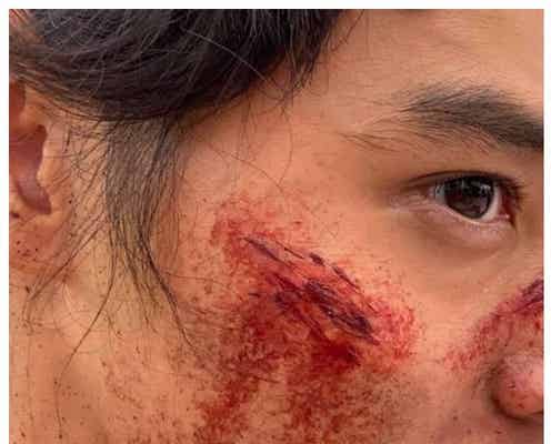 山崎賢人、リアルな“傷だらけ”特殊メイク公開「ドアップでも美しい」「まつ毛長すぎ」の声も