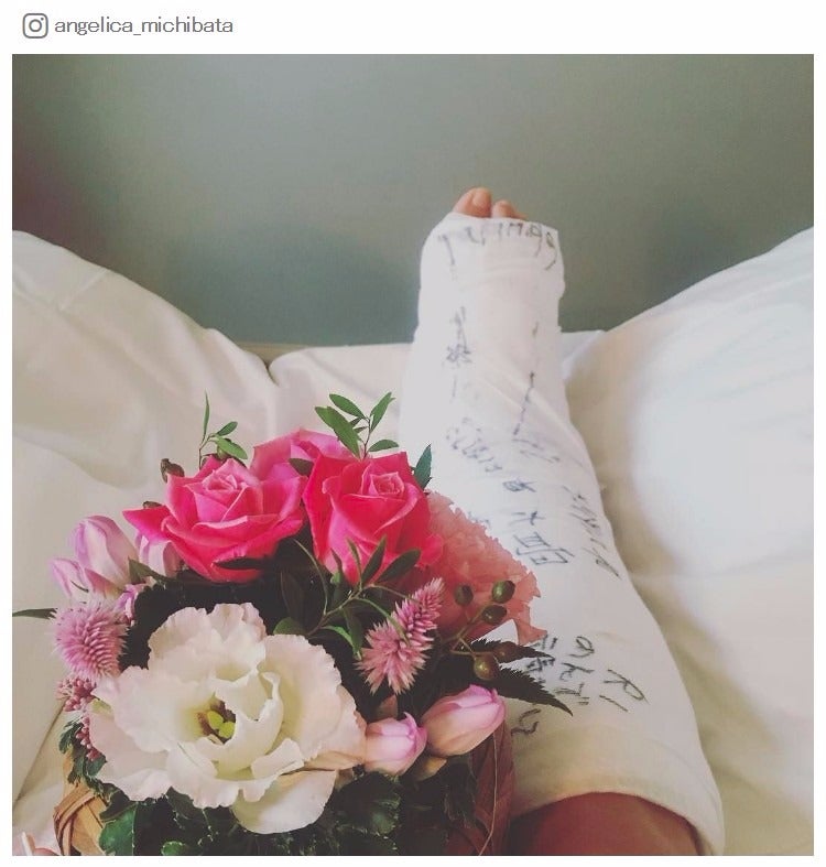 リハビリ開始を報告／道端アンジェリカInstagramより