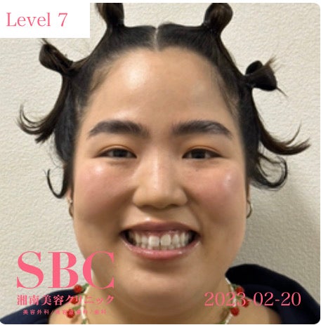 ゆりやんレトリィバァ／二重シミュレーションの様子（提供写真）