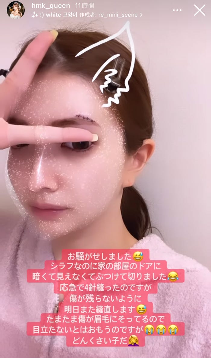 3ozubrem Upgdm 3ozubrem Upgdm
