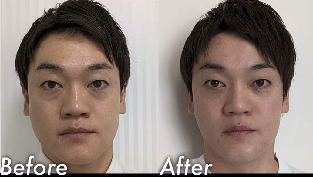 整形前後の比較写真／おばたのお兄さん公式YouTubeより