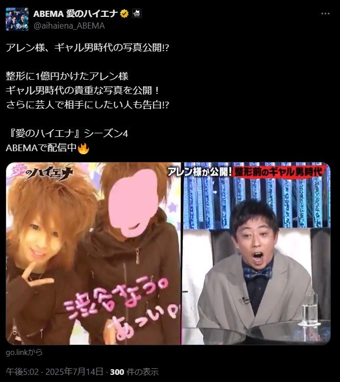 アレン様 アレン様、整形前の18歳ギャル男時代の写真公開 スタジオ衝撃