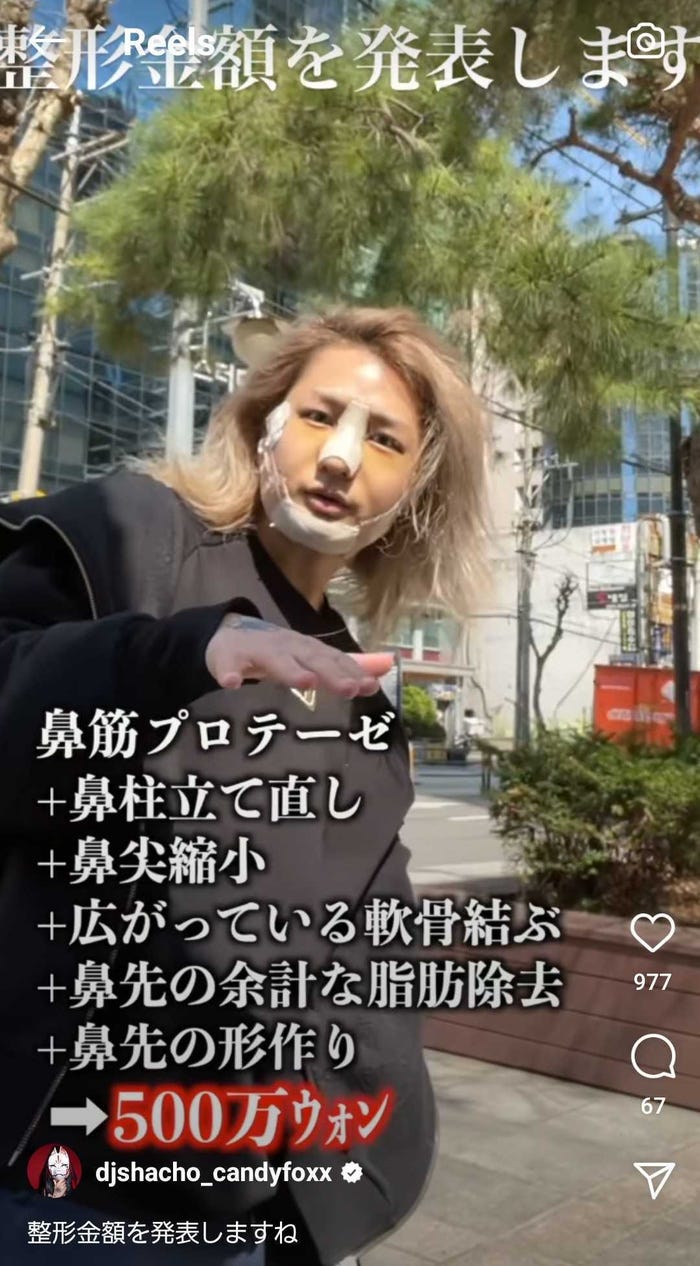 総額250万整形 のdj社長 術後1ヵ月経過報告 もっとイケメンになった 可愛い と反響 モデルプレス 総額250万整形 のdj社長 術後1ヵ月経過報告 もっとイケメンになった 可愛い と反響 モデルプレス