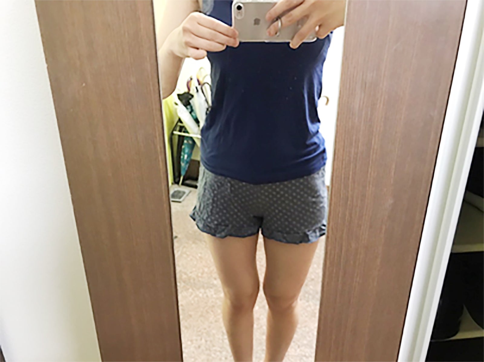 S・Nさん／30代女性