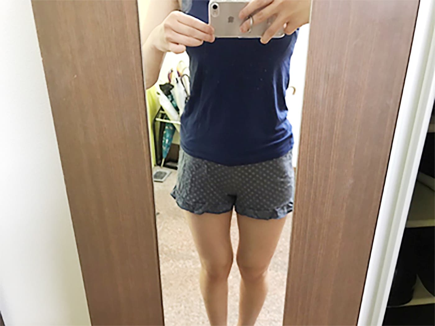 S・Nさん/30代女性