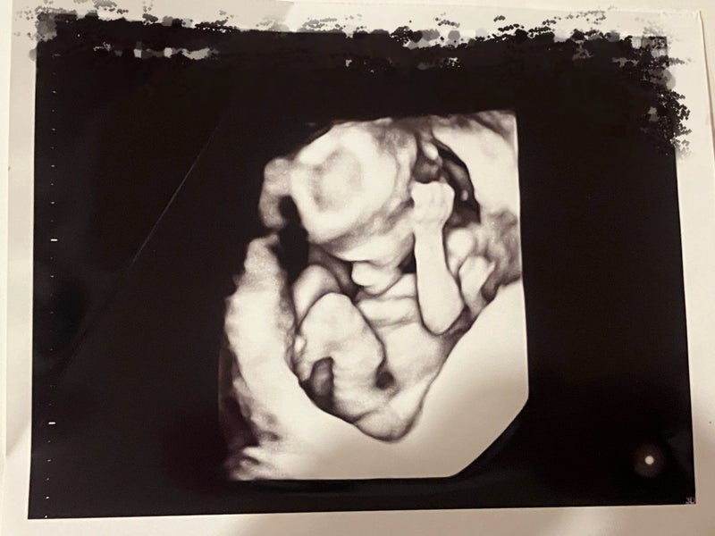 ネイボール オフィシャルブログより