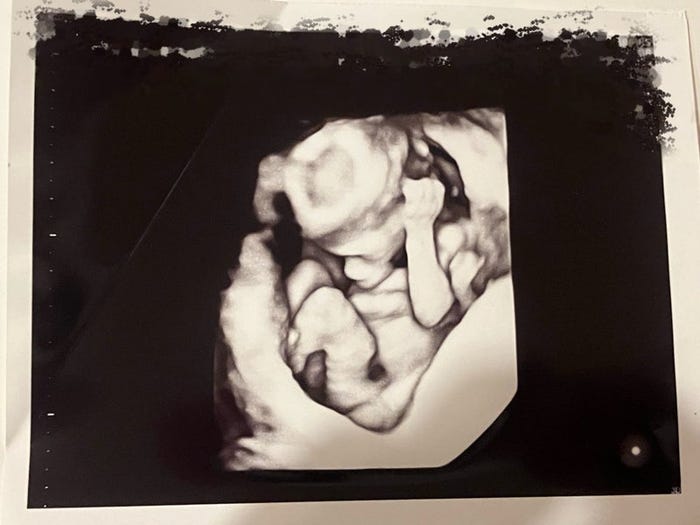 ネイボール オフィシャルブログより