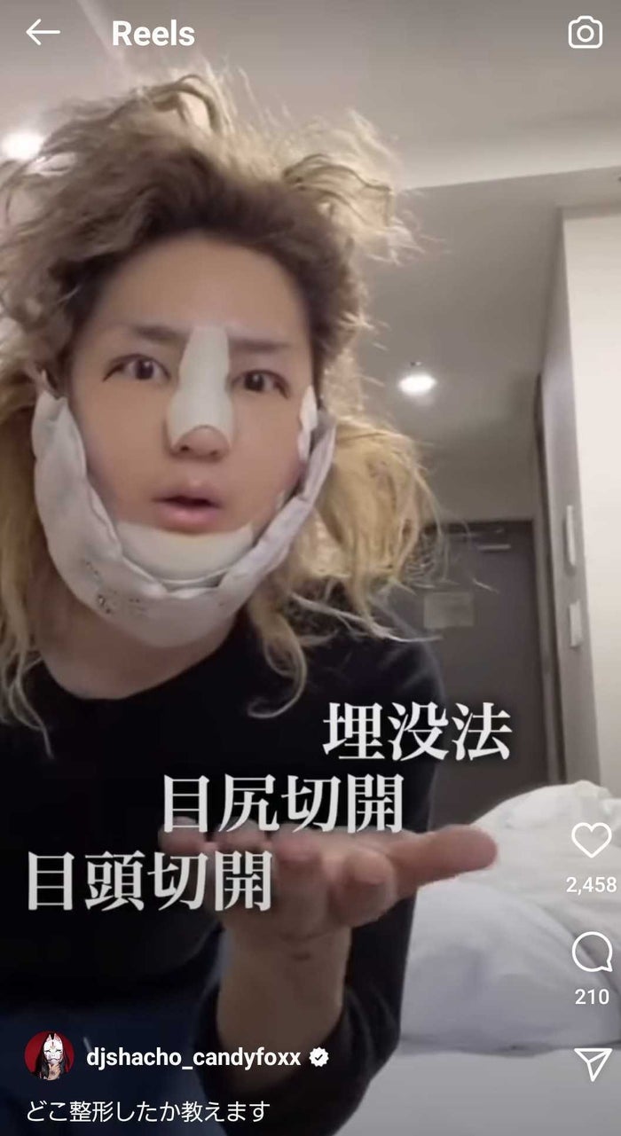 Dj社長 韓国整形内容詳細と各金額を公開 イケメン化 の声 モデルプレス Dj社長 韓国整形内容詳細と各金額を公開 イケメン化 の声 モデルプレス