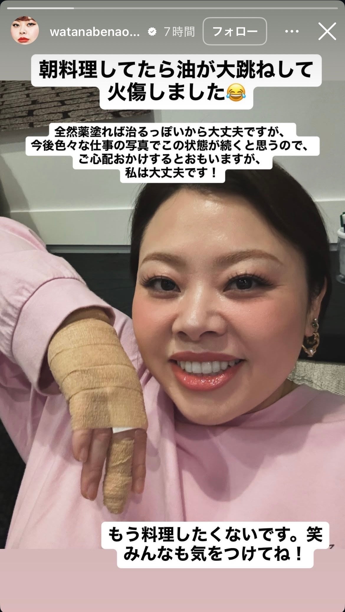 渡辺直美Instagramストーリーズより