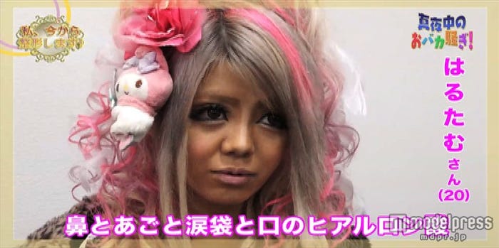 はるたむの整形手術に密着/「真夜中のおバカ騒ぎ」より