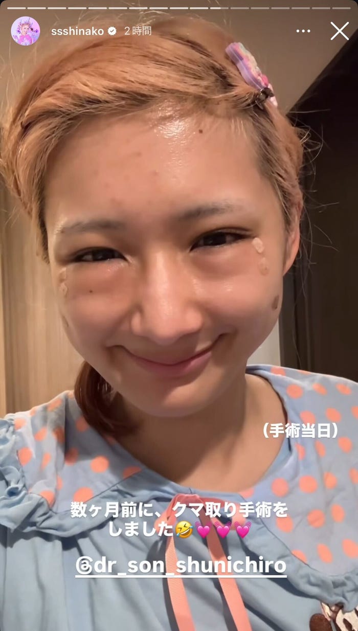 手術当日の姿/しなこInstagramストーリーズより