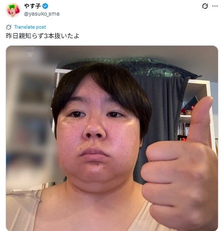 やす子、親知らず同日3本抜歯を報告 自撮り写真公開 - モデルプレス