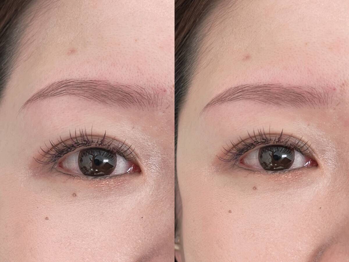 骨格と眉山の位置の関係