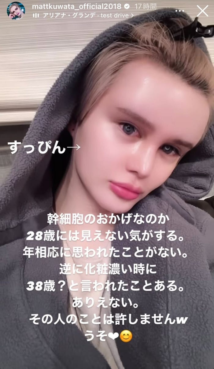 Matt公式Instagramストーリーズより