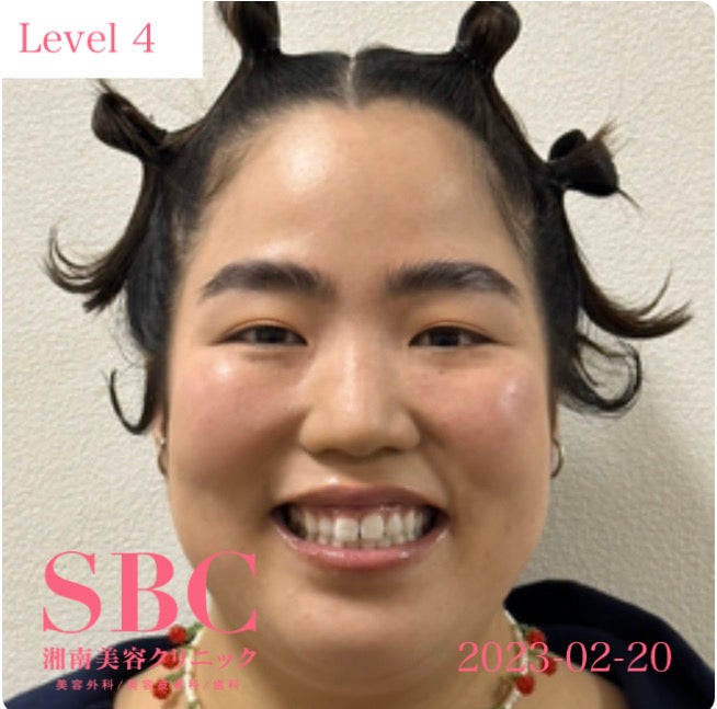 ゆりやんレトリィバァ／二重シミュレーションの様子（提供写真）