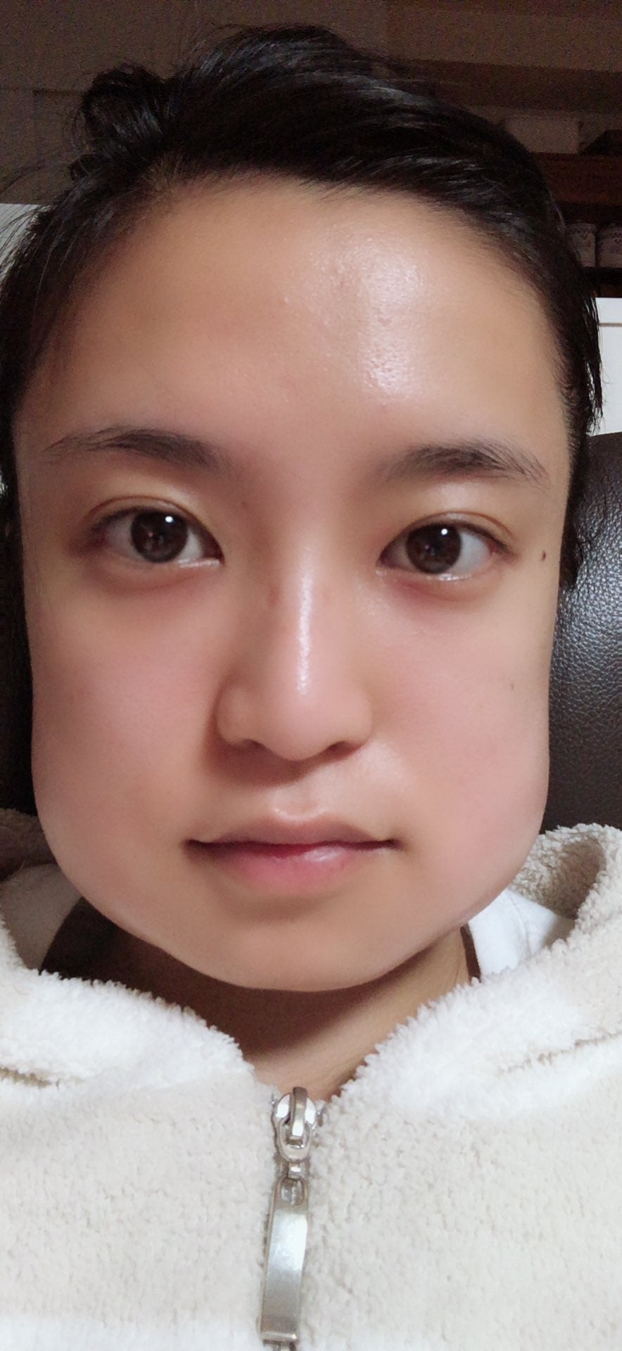 小島瑠璃子、親知らず抜歯後の別人級ショット公開「変顔にするアプリじゃないよ」