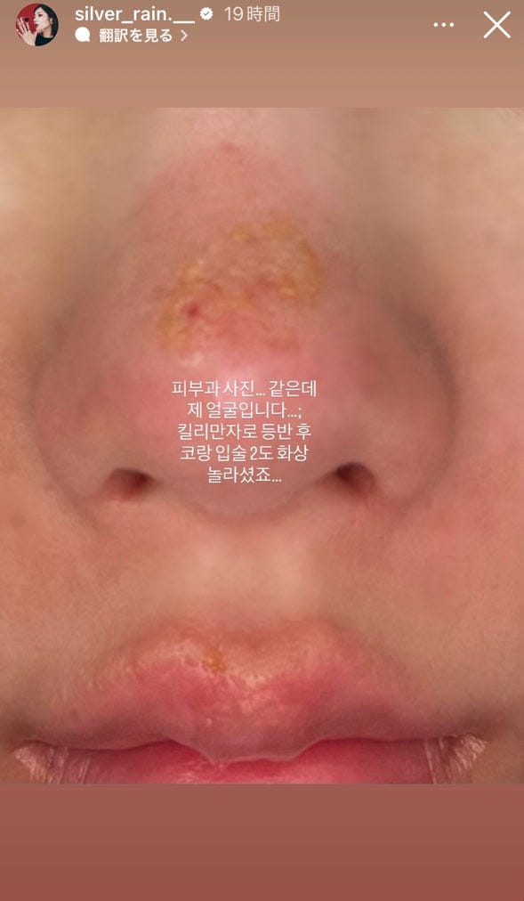 クォン・ウンビInstagramより